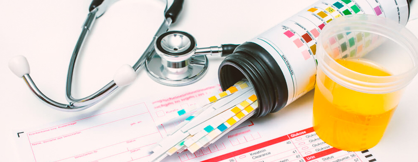 exame-quimico-urina-tira-reagente-biomedicina-online