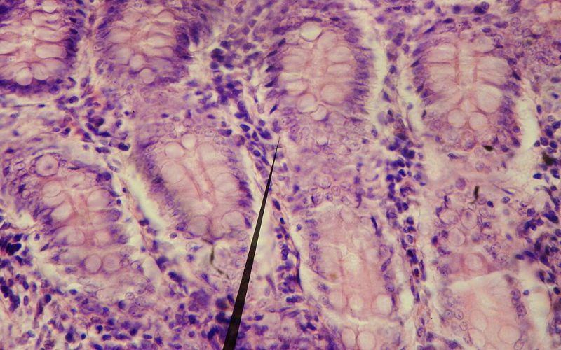 criptas-de-lieberkhun-o-que-sao-funcoes-fisiologia.biomedicinaa