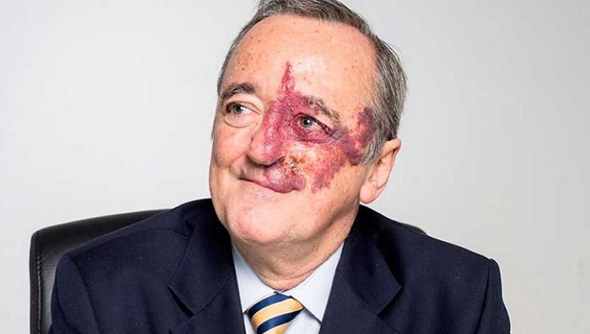 mariano-barbacid-combinacao-tripla-de-medicamentos-avanco-cura-do-cancer-de-pancreas