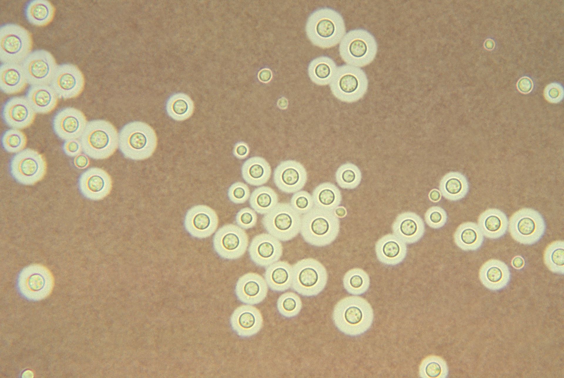 microscopio-cryptococcus-neoformans-teste-tinta-da-china-nanquim-biomedicina