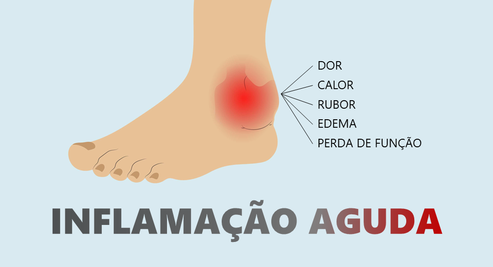 inflamatório o-que-e-inflamacao-sinais-cardinais-fases-mediadores-do-processo-inflamatorio-biomedicina