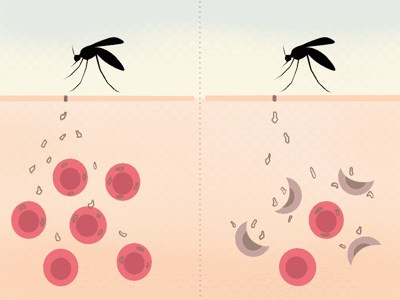 como-anemia-falciforme-protege-contra-malaria-biomedicina
