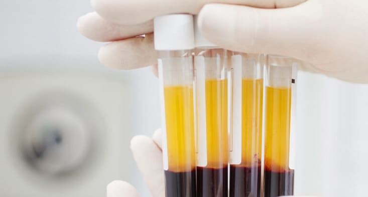 diferencas-entre-plasma-e-soro-biomedicina