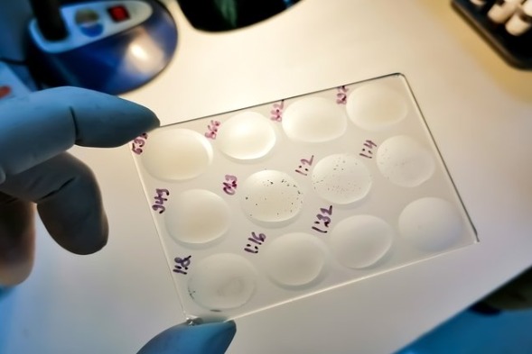 testes-treponemicos-nao-treponemicos-diferencas-interpretacao-diagnostico-sifilis-biomedicina